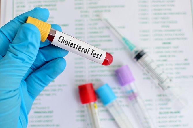 Zastrzyk z połączenia leków opracowanego przez naukowców wykonany dwa lub trzy razy w roku skutecznie i trwale obniża poziom złego cholesterolu