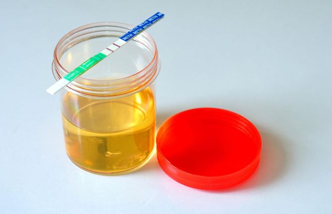Escherichię coli można wykryć dzięki badaniu moczu.