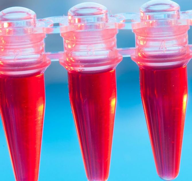 Niski poziom hemoglobiny jest przykładowo objawem niedoboru żelaza
