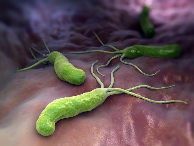 Helicobacter pylori to bakteria występująca u osób cierpiących na wymioty czy zgagę