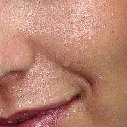 Kobieta cierpiąca na nadmierną potliwość