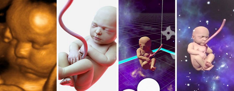 Nowe technologie i możliwość oglądania nienarodzonego dziecka