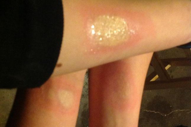 Salt and ice challenge to wyzwanie popularne w Wielkiej Brytanii