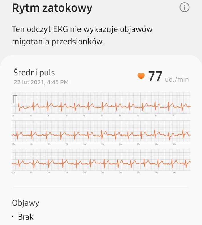 ekg samsung watch 4