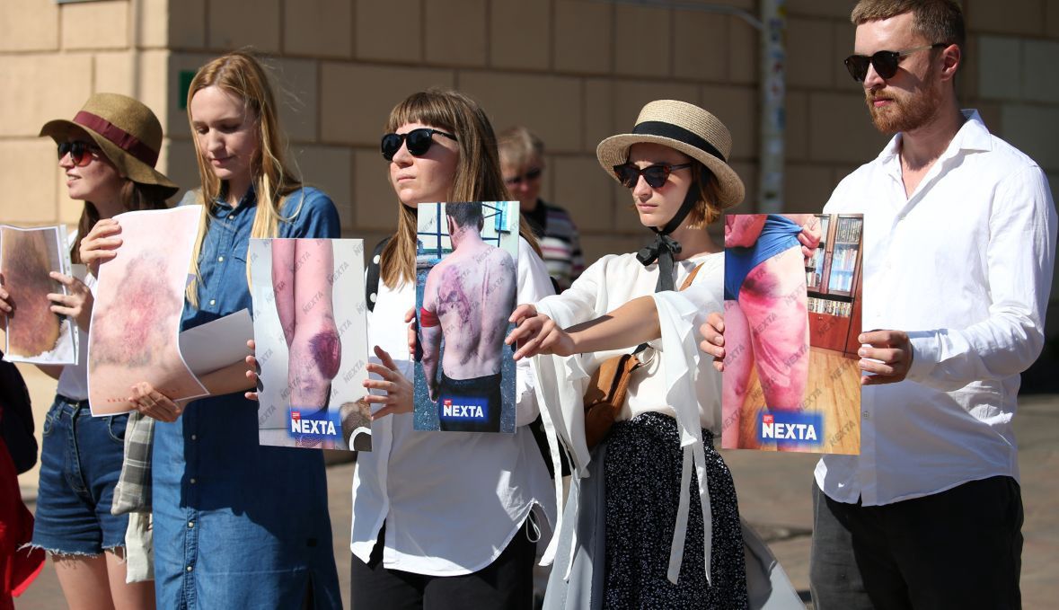 Ludzie pokazują zdjęcia obrażeń, które milicja zadała protestującym. Ukazały się najpierw na kanale NEXTY