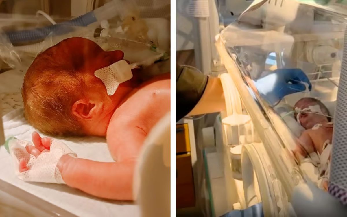 Father seeks help after daughter born prematurely at 31 weeks