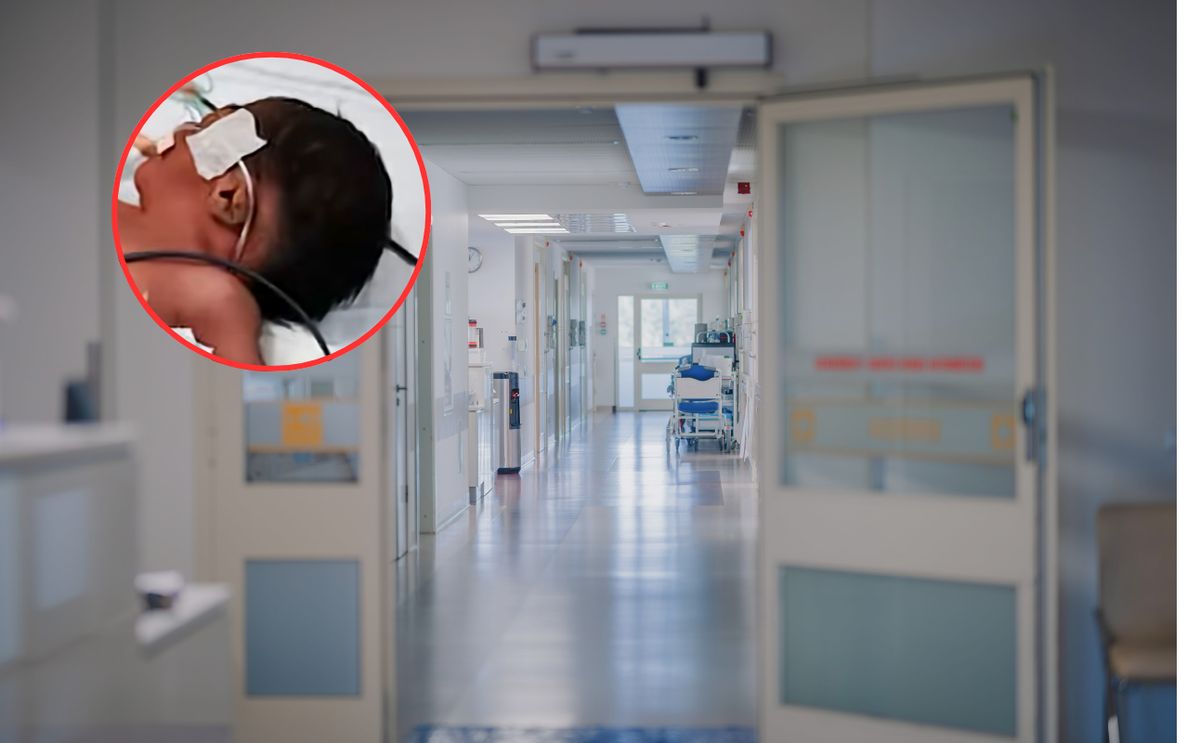 Noworodek z dwiema głowami urodzony w Indiach: lekarze walczą o jego życie