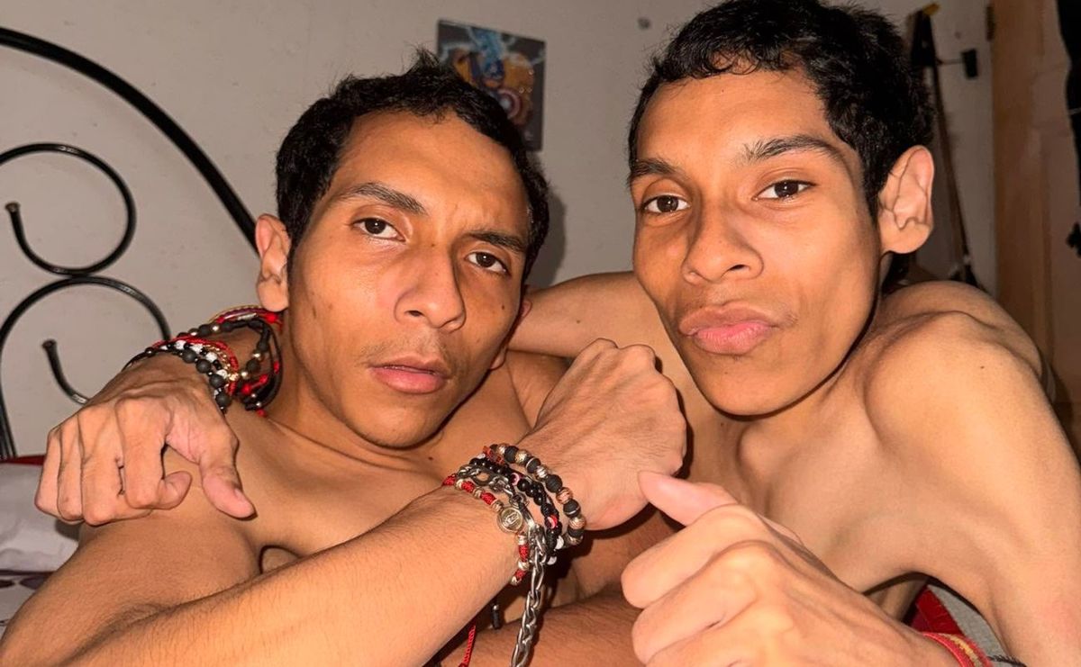 Conjoined twins José Luis and José Armando Cevallos from Ecuador die at 27