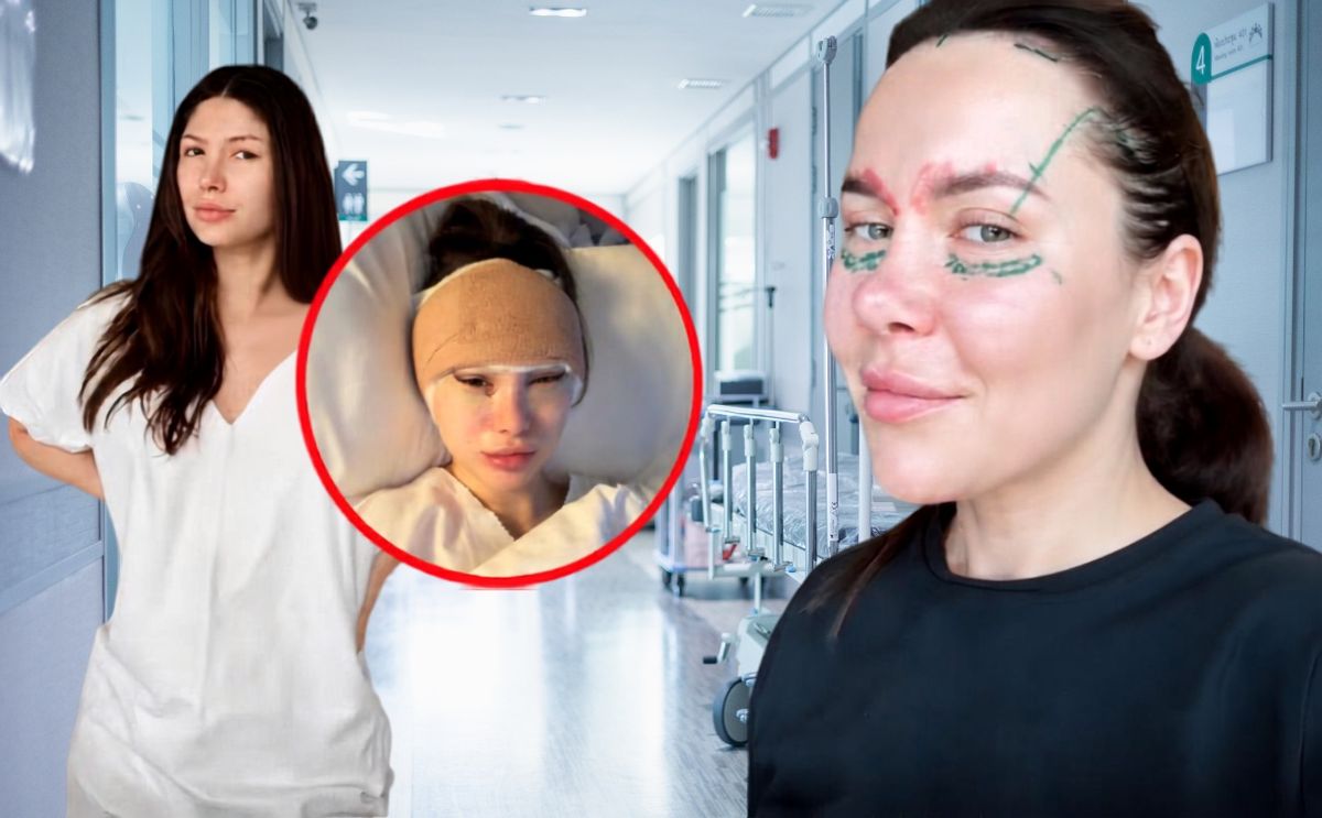 Influencerki przed 30. decydują się na operacje plastyczne