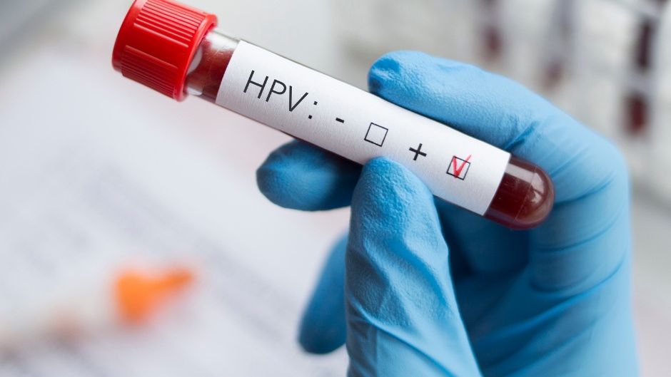 HPV - rak szyjki macicy