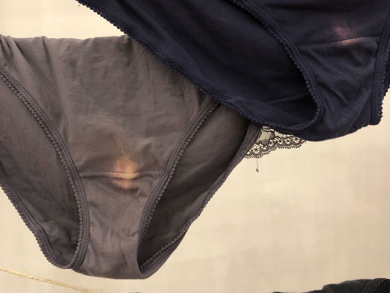 This bleached patch in your underwear is completely normal
