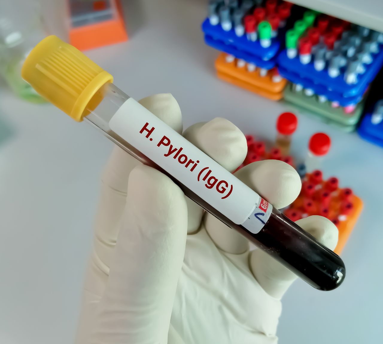 Helicobacter pylori – jak zdiagnozować i leczyć?