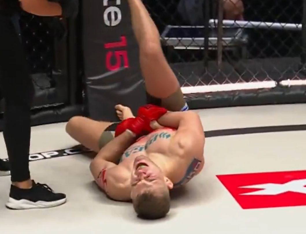 Wojciech Kawa zakończył karierę w MMA z powodu fatalnej kontuzji