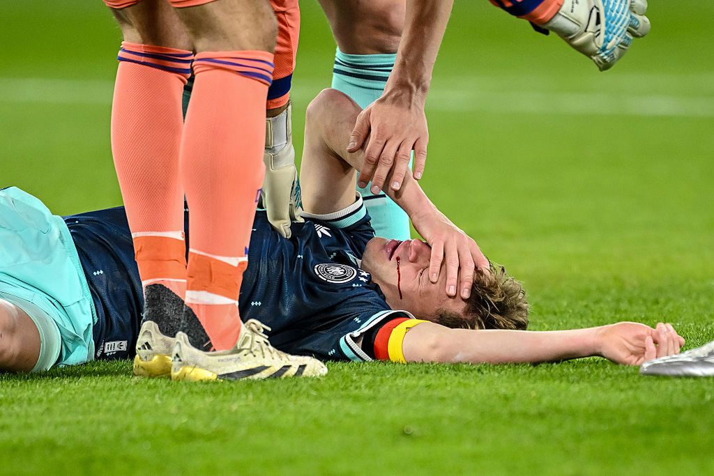 Niemiecka gwiazda potraktowana łokciem. Polała się krew