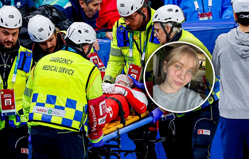 Tak wygląda twarz Polki po okropnym wypadku. Jej słowa mówią wszystko