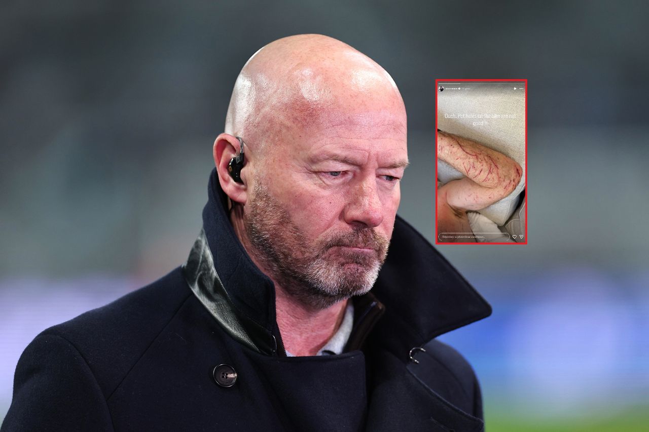 Niebezpieczny upadek legendy. Takich doznał obrażeń