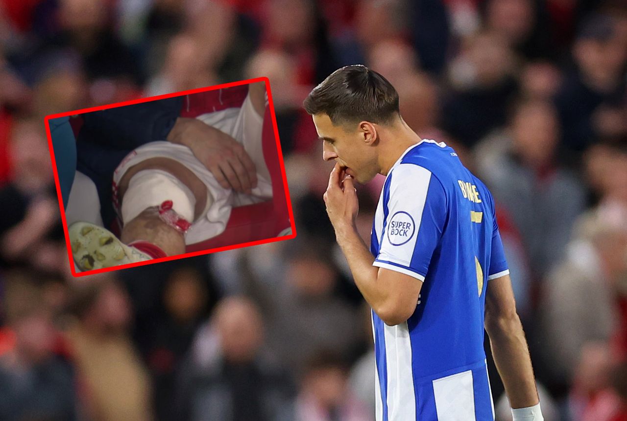 "Skaskował" go Bednarek. Tak wygląda noga piłkarza Nottingham