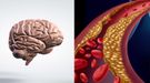 Cholesterol a mózg. Zobacz, jaka jest między nimi zależność (WIDEO)