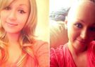23-latka zmarła na raka szyjki macicy. 15 razy odmawiano jej wykonania badań