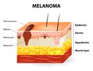 Melanocyty - właściwości, funkcje, najczęstsze schorzenia