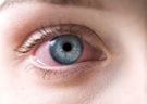 Alergia drażni oczy? Sprawdź, jak sobie pomóc
