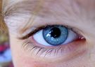 Oparzenie oka - rodzaje, objawy, pierwsza pomoc