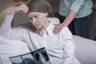 Pacjenci, którzy chorowali na raka skóry, są 3 razy bardziej narażeni na inne nowotwory