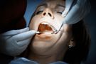 Próchnica - klasyfikacja, przyczyny, objawy, leczenie, profilaktyka, próchnica a prawidłowa higiena jamy ustnej, próchnica wczesna