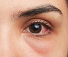Jednodniowe soczewki kontaktowe ulgą dla alergików