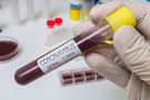 Koronawirus w Polsce. Dlaczego lepiej nie robić testu, kiedy nie ma objawów? Wyjaśnia dr Ernest Kuchar 