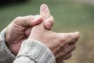 Wybity kciuk - przyczyny, objawy i leczenie