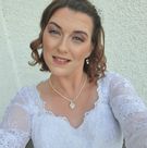 34-latkę uczuliła suknia ślubna. Jej ciało pokryły swędzące krosty