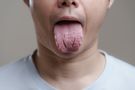 Język mosznowy to groźny objaw. Ujawnia poważne niedobory w organizmie