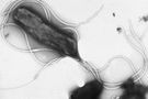 Helicobacter pylori pod mikroskopem