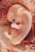 Ludzki zarodek z ciąży jajowodowej w 7-8 tygodniu życia