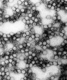 Żółta febra - widok mikroskopowy wirusa 