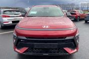 Hyundai Kona 1.6 GDI N Line DCT