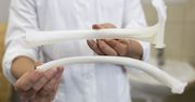 Udane wszczepienie implantu żebra z polskiej drukarki 3D