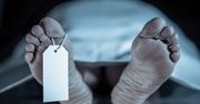 Pojawiły się po śmierci. Naukowcy przyglądali się 36 ludzkim zwłokom