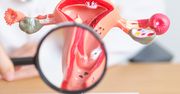 Zmiany keratotyczne w cytologii – co oznaczają i czy są groźne?