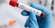 Rak szyjki macicy (HPV) – jak się chronić?