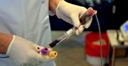 Apel do ozdrowieńców o oddanie krwi. Każdy z was może przyczynić się do uratowania komuś życia