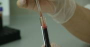 Pandemia uderzyła w pacjentów z nowotworami. Część przerwała leczenie