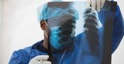 Rok po hospitalizacji z powodu COVID-19 co trzeci pacjent nadal ma zmiany w płucach.