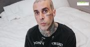 Travis Barker rzucił zażywanie leków na receptę po tym, jak przeżył katastrofę samolotu.