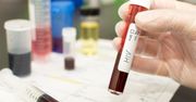 HIV nie daje objawów przez wiele lat. Każdy powinien wykonać test!