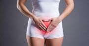 Endometrioza wymaga kompleksowego podejścia