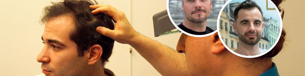 Komórki macierzyste, terapie genowe i laseroterapia. Nowe technologie w walce z łysieniem