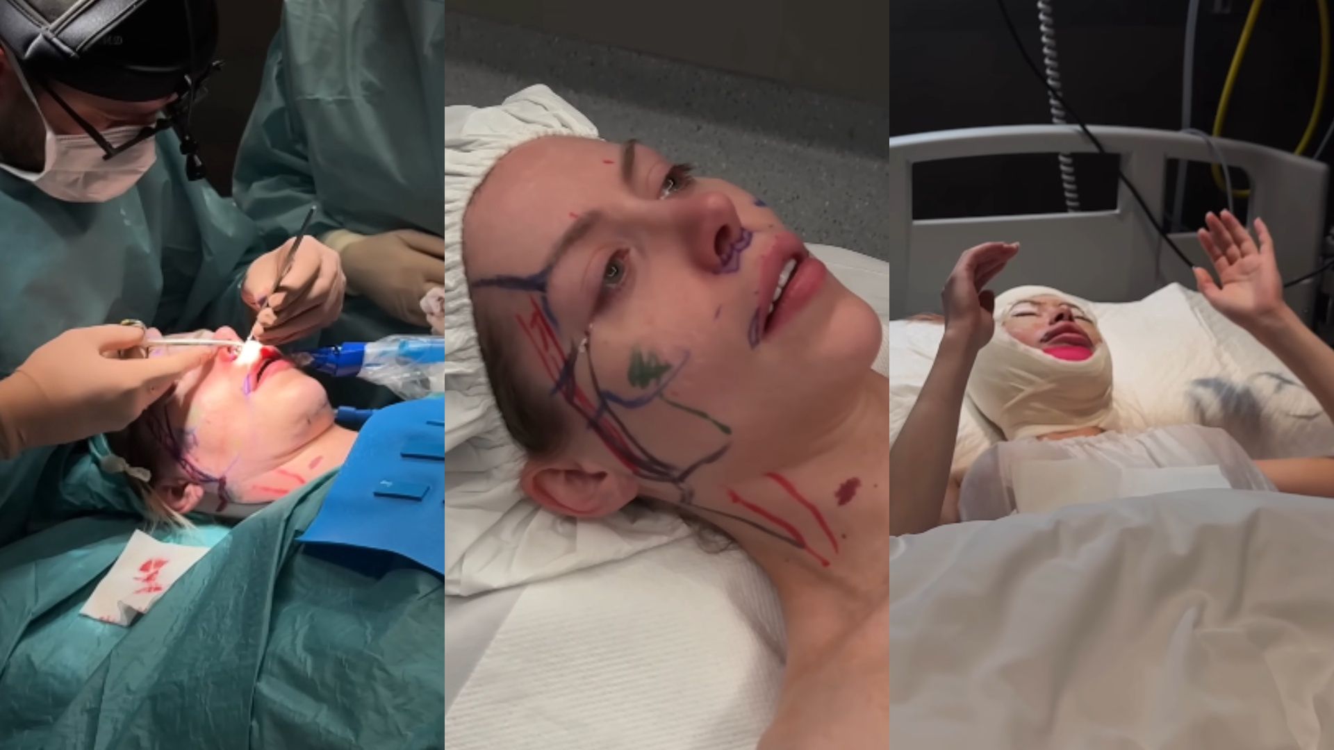 Julia von Stein prezentuje film z SALI OPERACYJNEJ, gdzie wykonano jej LIFTING