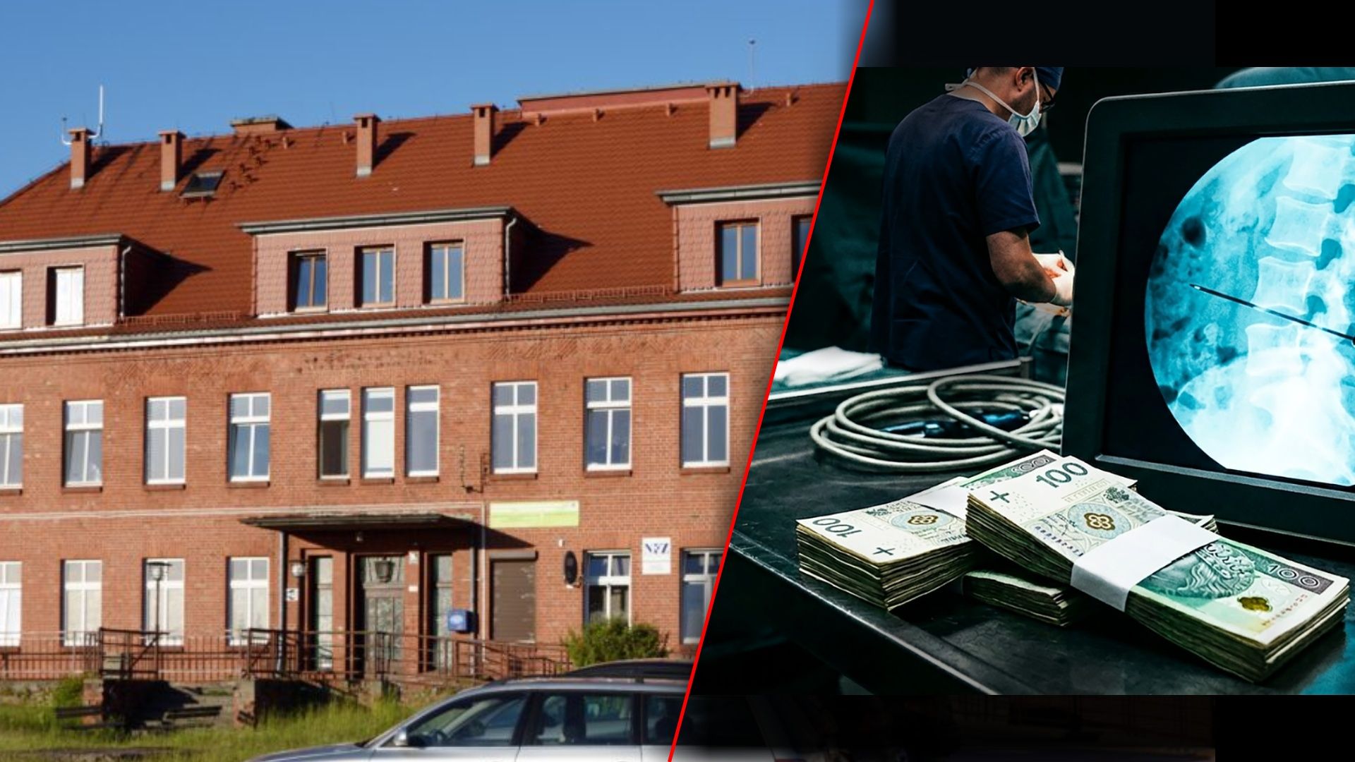 Ponad 13 mln zł kary dla szpitala w Miastku. Chodzi o działania spółki neurochirurgów